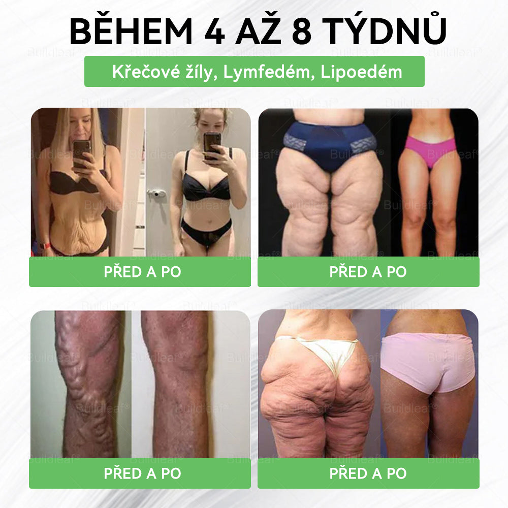 Oficiální obchod ČR | BuildLeaf® GLP-1 8-v-1 Fit & Vital Řešení (Jednou denně, viditelné změny za 7 dní) ✅ Obezita, kardiovaskulární zdraví, cukrovka, spánková apnoe, zdraví střev, problémy se klouby a další.